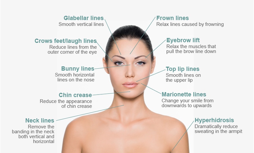 Bewitched Botox MedSpa - Up To 10% Off - Spring, TX | Groupon