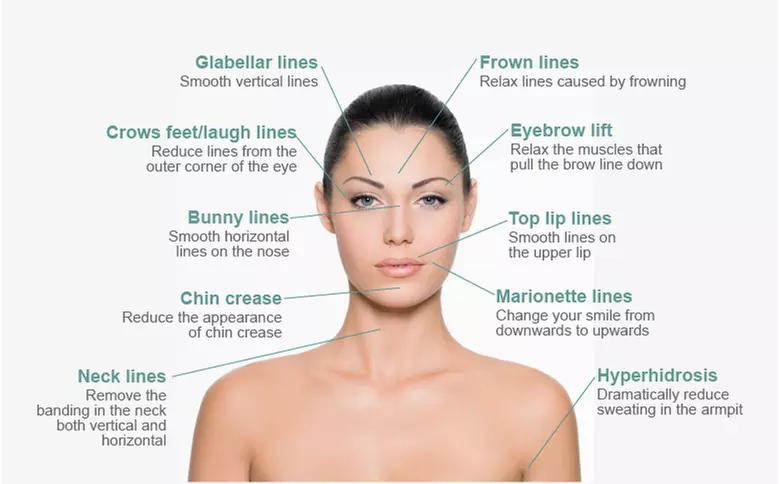 Discover Bewitched Botox LLC's Xeomin Options: 20, 40, or 60 Units for Up to 25% Off Smooth Facial Wrinkles - Primary Image