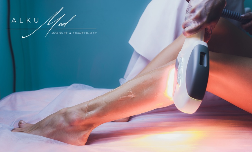 Image 1: Do 27% zniżki na Redukcja tłuszczu/cellulitu - niemarkowe w ALKU-MED | Medicine & Cosmetology