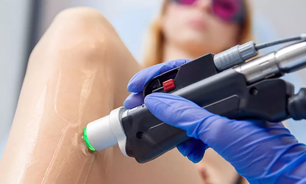 Up to 15% Off on Laser Hair Removal at Bloom Health - Primary Image