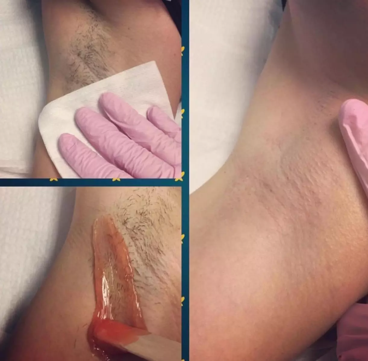 Waxing Services for Bikini, Brazilian and Brow Areas
