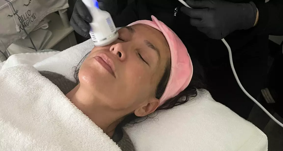 Transform Your Skin: Microneedling with Cryo & Glutathione(Up to 67% Off) - Primary Image