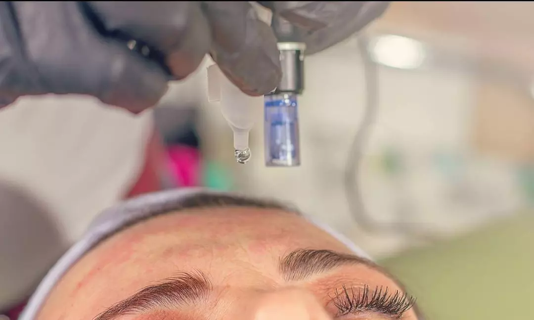Up to 30% Off on Micro-Needling at Dermapure, LLC
