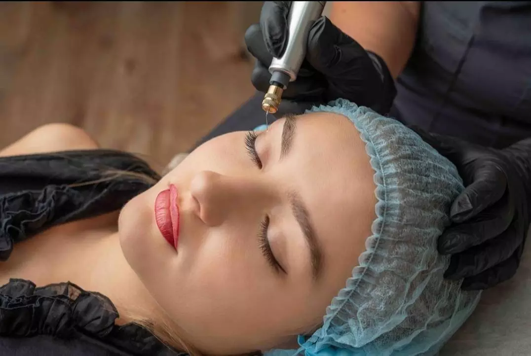 Up to 30% Off on Micro-Needling at Dermapure, LLC