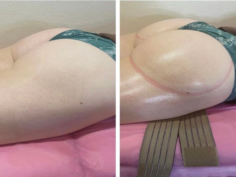 The Non-Surgical Butt Lift That Feels as Good as It Looks!