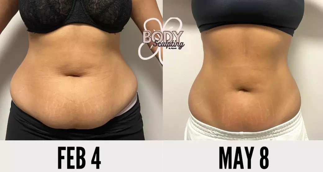 Up to 46% Off on Cavitation at Body Sculpting By Mykah - Second Medium
