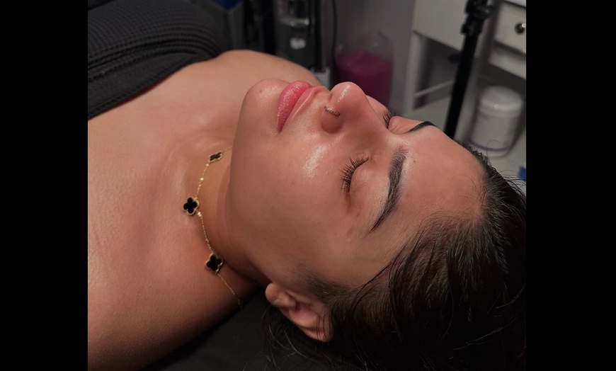 Image 1: Up to 32% Off on Microdermabrasion at La Bella Vita Beauty Spa