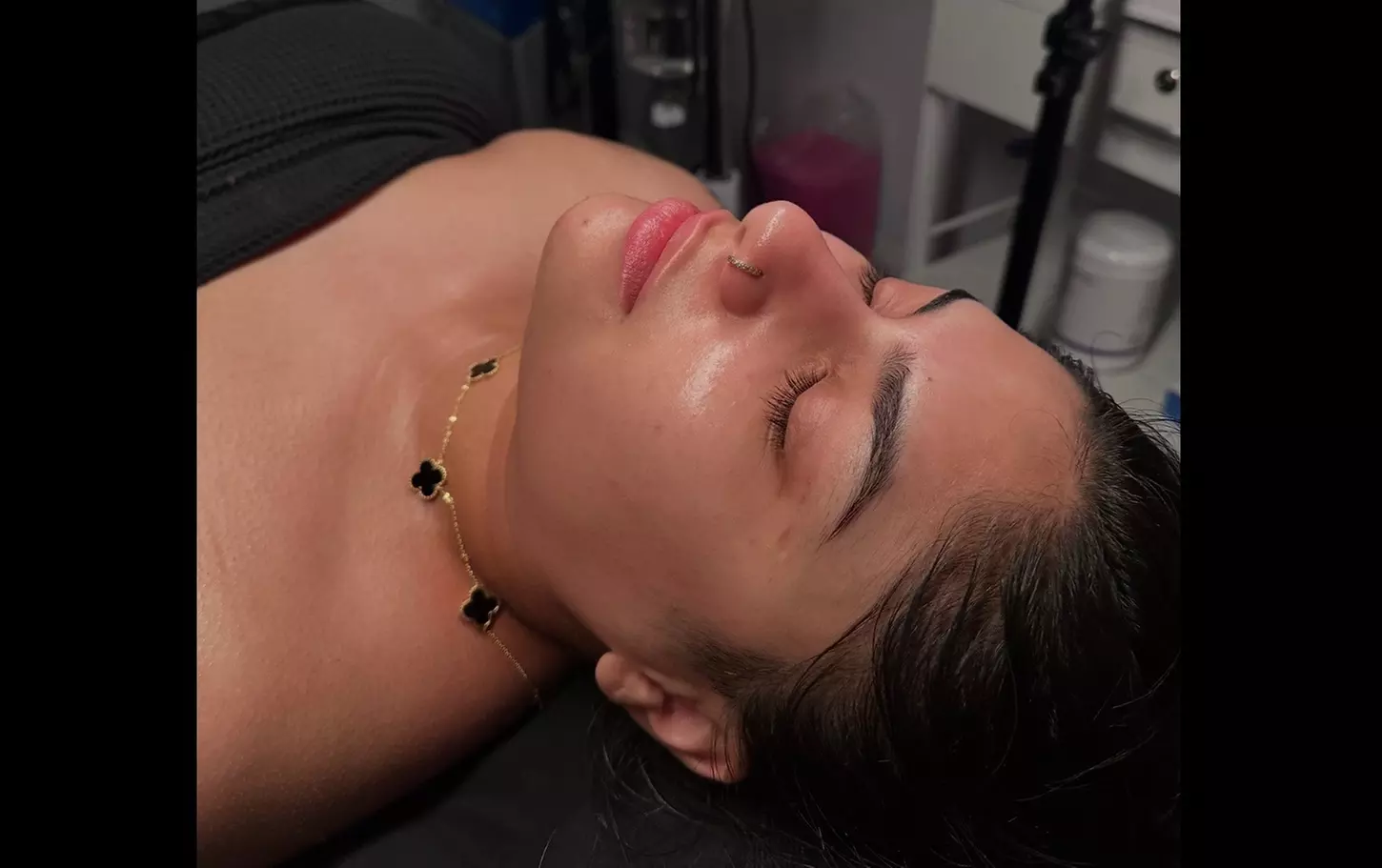 Up to 32% Off on Microdermabrasion at La Bella Vita Beauty Spa