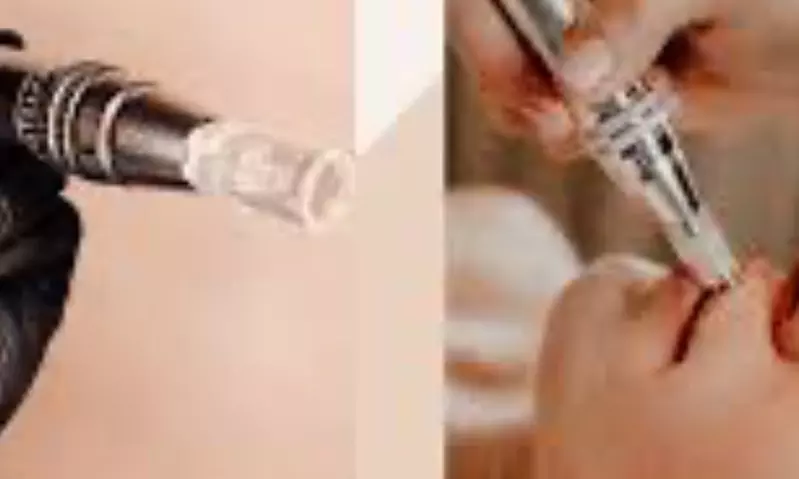 Revitalize Lips with Nano-Needle Enhancement + Opt Touch up 2 Weekst at ML ESTHETICS (Up To 30% Off) - Primary Image
