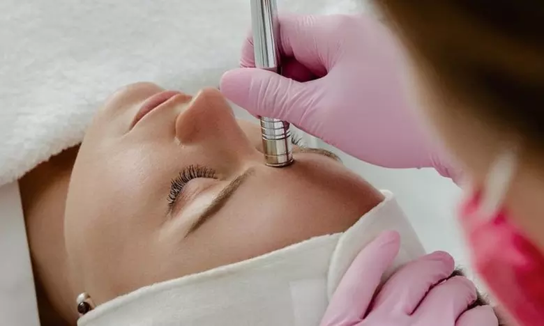 Experience Smoother Skin with Microdermabrasion Treatment