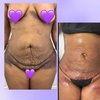 Image 1: Lymphatic Drainage Massage at THAE Beauty Studio