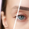 Image 1: Up to 46% Off on Tattoo Removal at Elevate Beauty Lounge