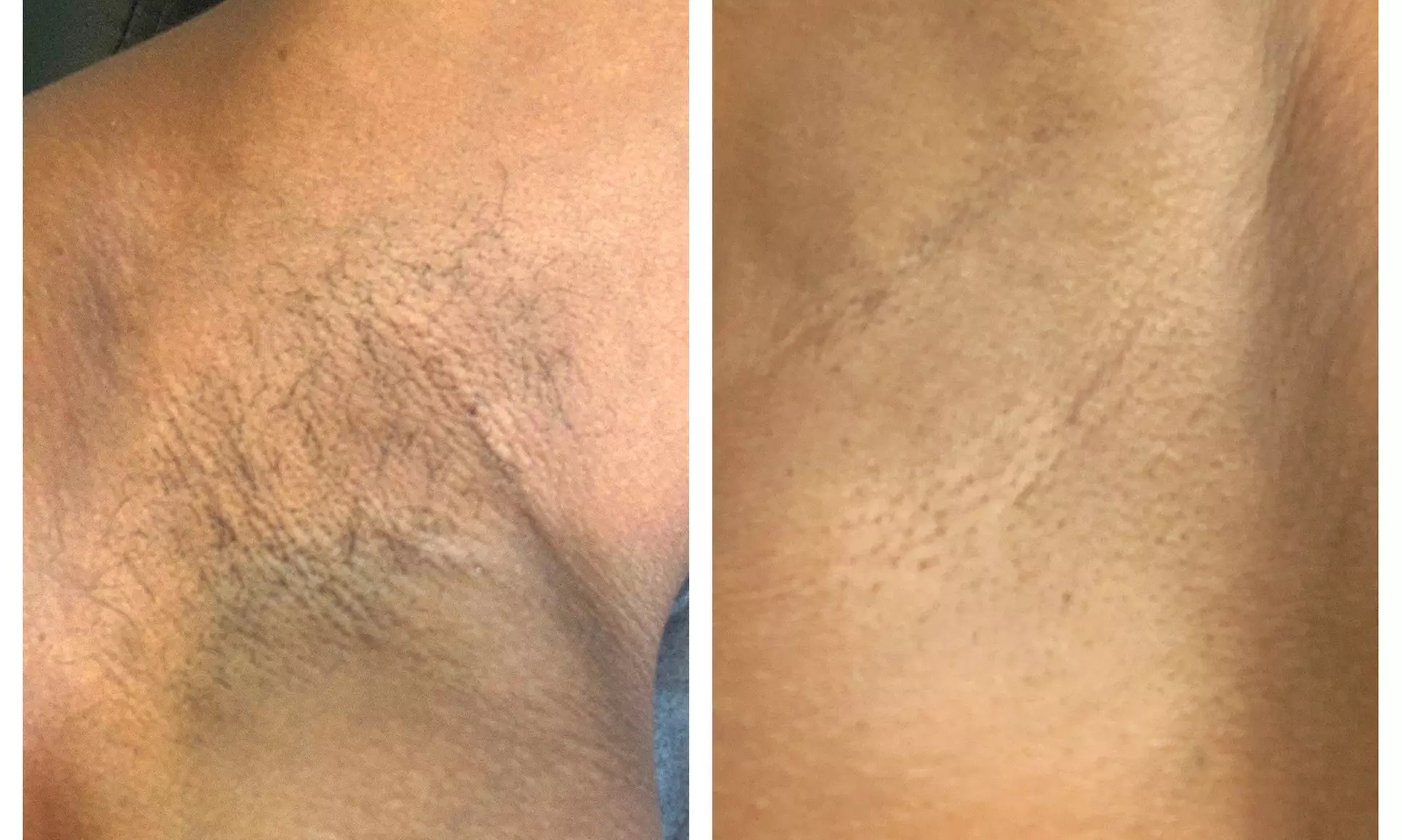 Up to 28% Off on Waxing - Brazilian at Touché by CoCo - Second Medium
