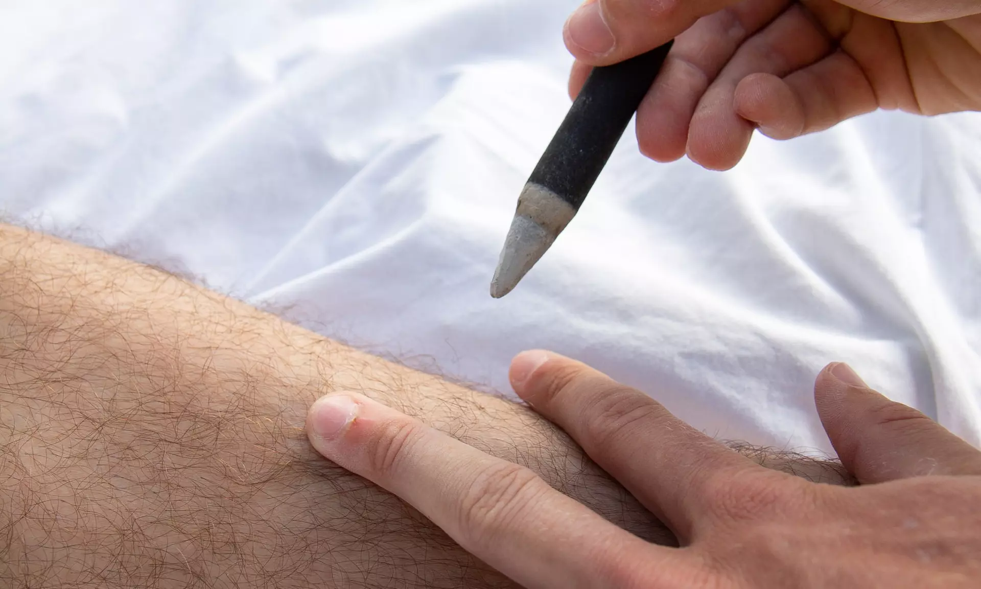 Experience a One-Hour Acupuncture Session for Pain Relief