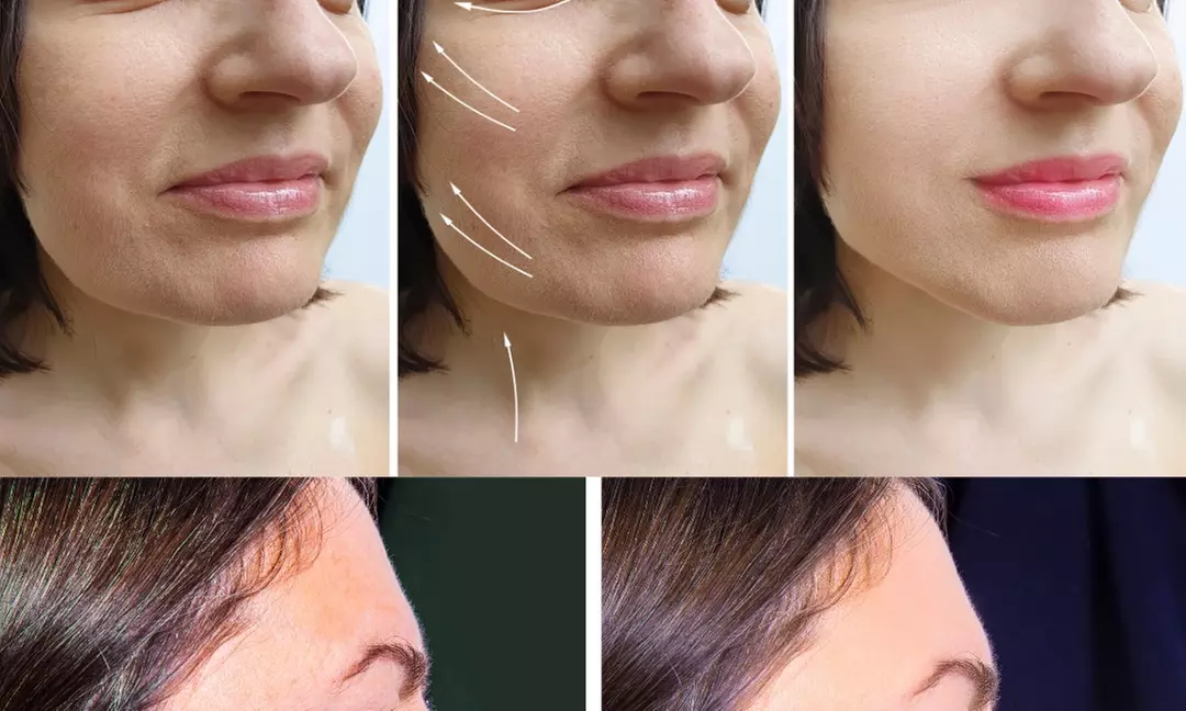 Enhance your skin at Mavii Beauty Lounge with Micro-Needling options, including LED Light Therapy and up to 39% off