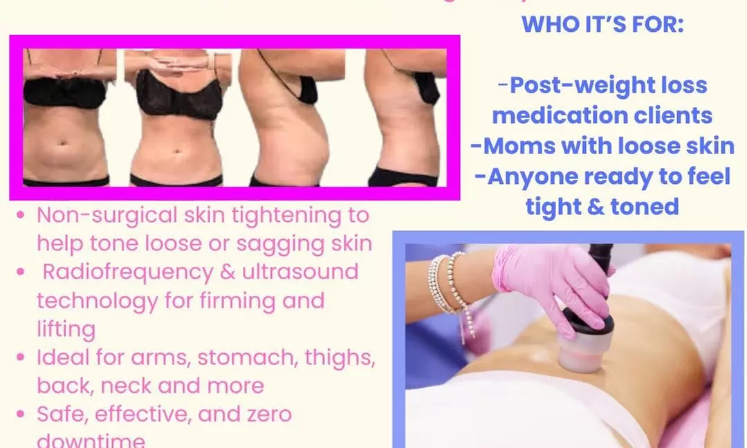 Experience Targeted Fat Reduction & Tightening w/ Slim & Sculpt, Detox, or More @ AB Botox Queen (Up to 39% Off) - Primary Image