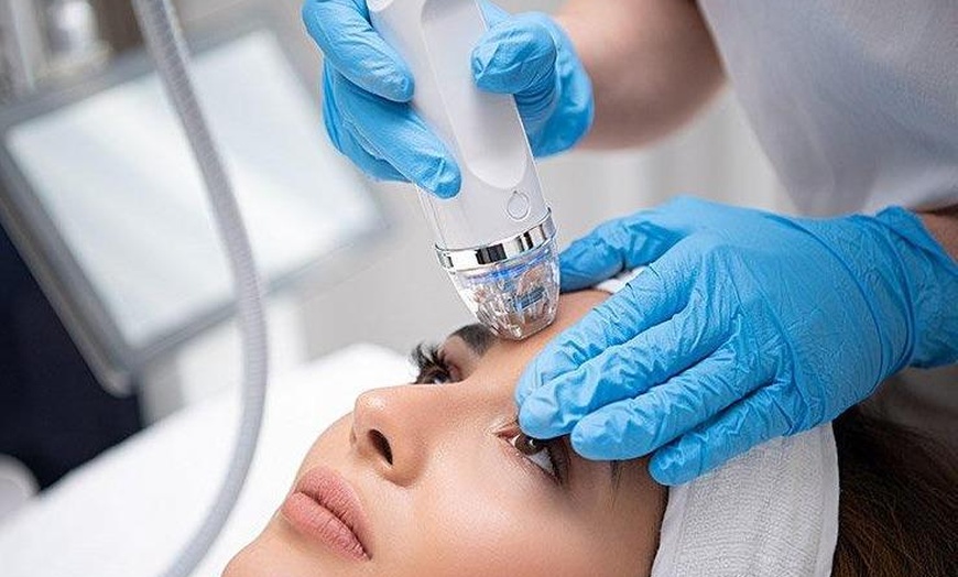 Image 8: Up to 55% Off on Micro-Needling at UK Aesthetics Lounge