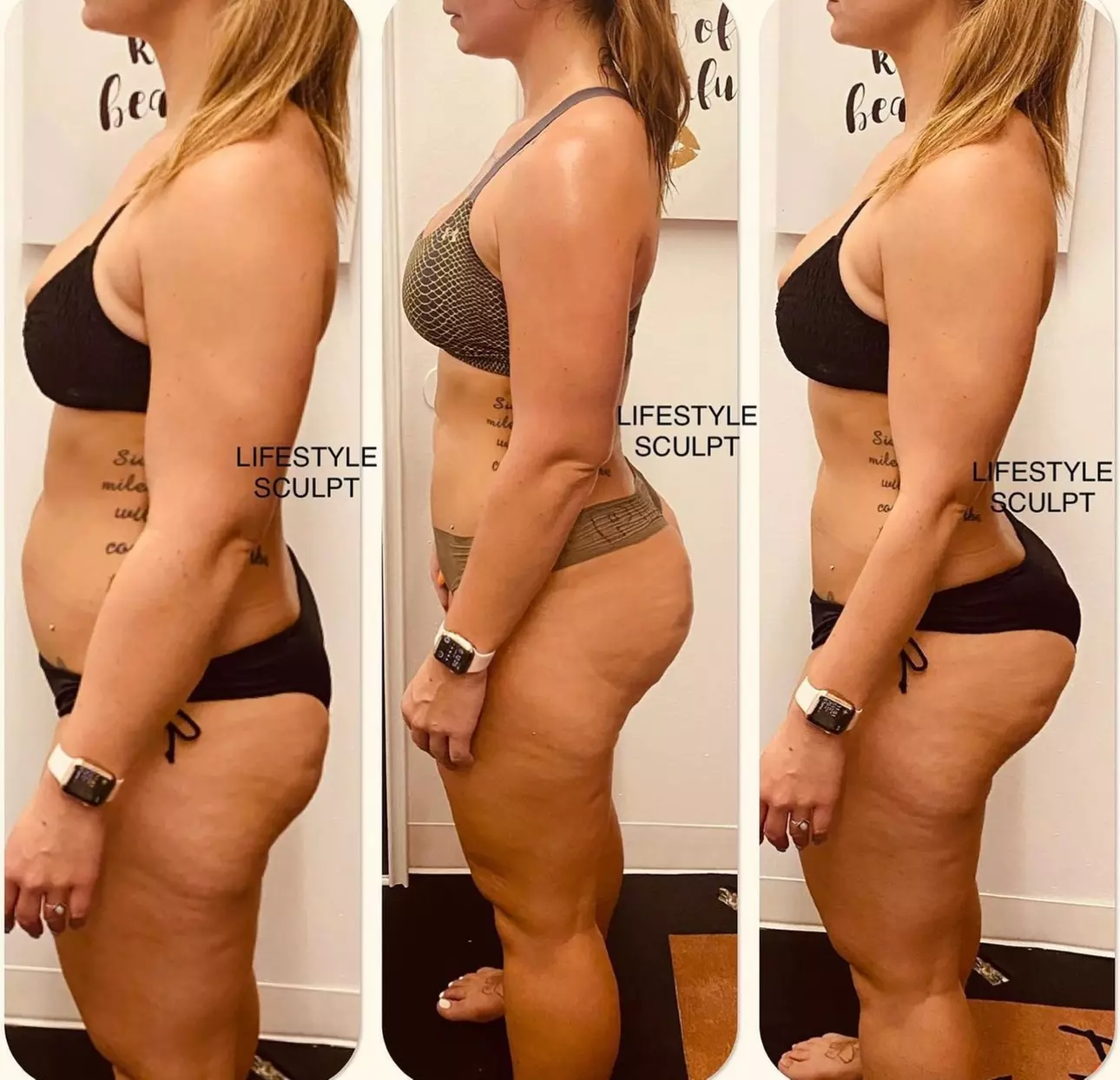 Up to 70% Off on Lipo - Non-Invasive Laser-iLipo at Lifestyle sculpture - Second Medium