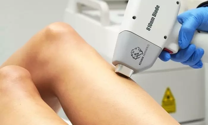 Smooth Skin with Laser Hair Removal Sessions Available