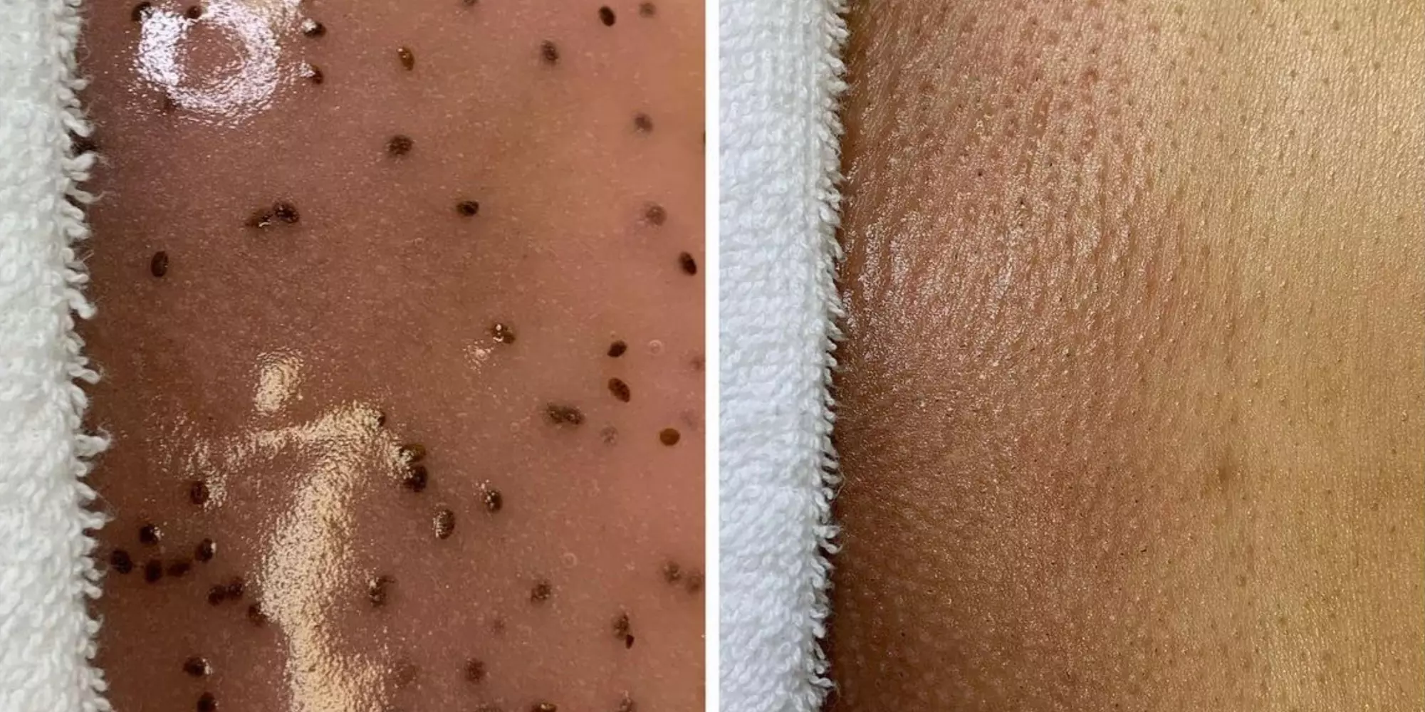 Choose from Brazilian Waxing or Hydrating Treatment Options