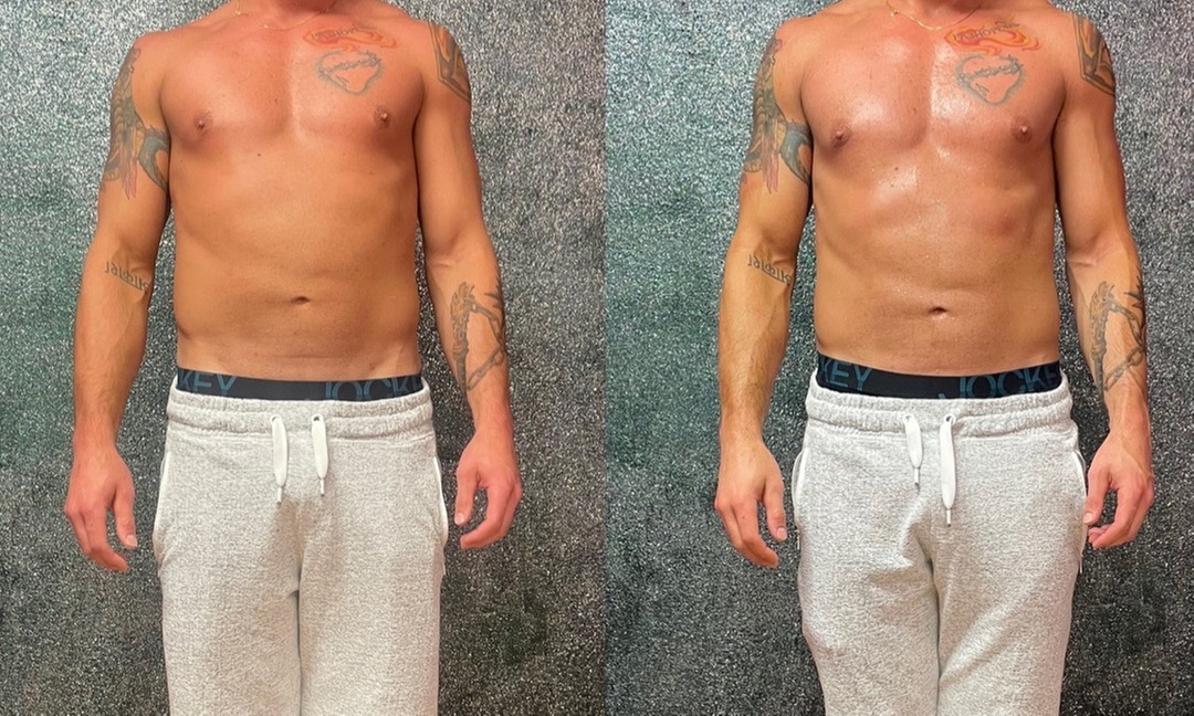Get Toned with EmSculpt and Sauna Bed Treatments