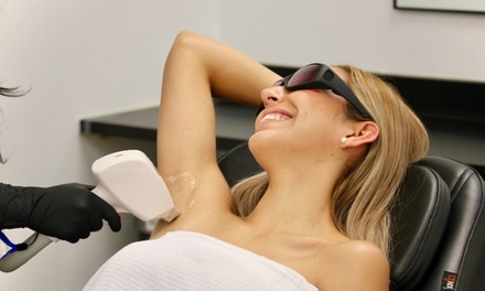 Six Laser Hair-Removal Sessions on One Medium Area - Peach Skin & Laser - Tempe