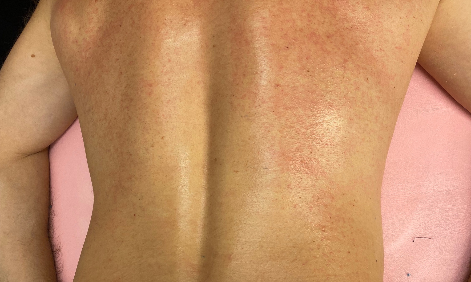 Enjoy a Hair-free Look: One Men’s Chest or Back Wax or Both