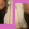 Image 6: Get Total Body Sculpt, Peach Perfection, / Mommy Makeover Glow Package 