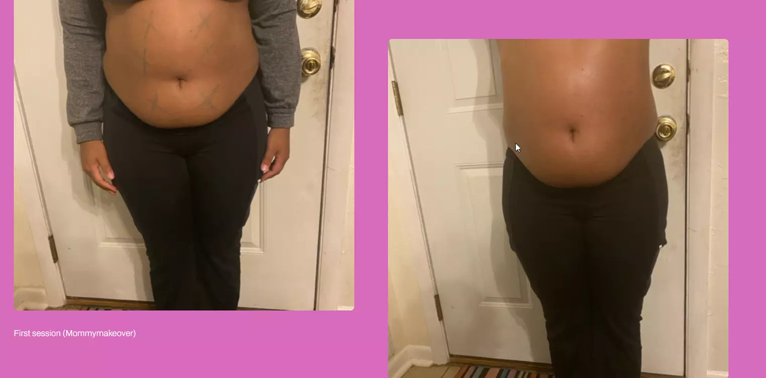 Get Total Body Sculpt, Peach Perfection, / Mommy Makeover Glow Package