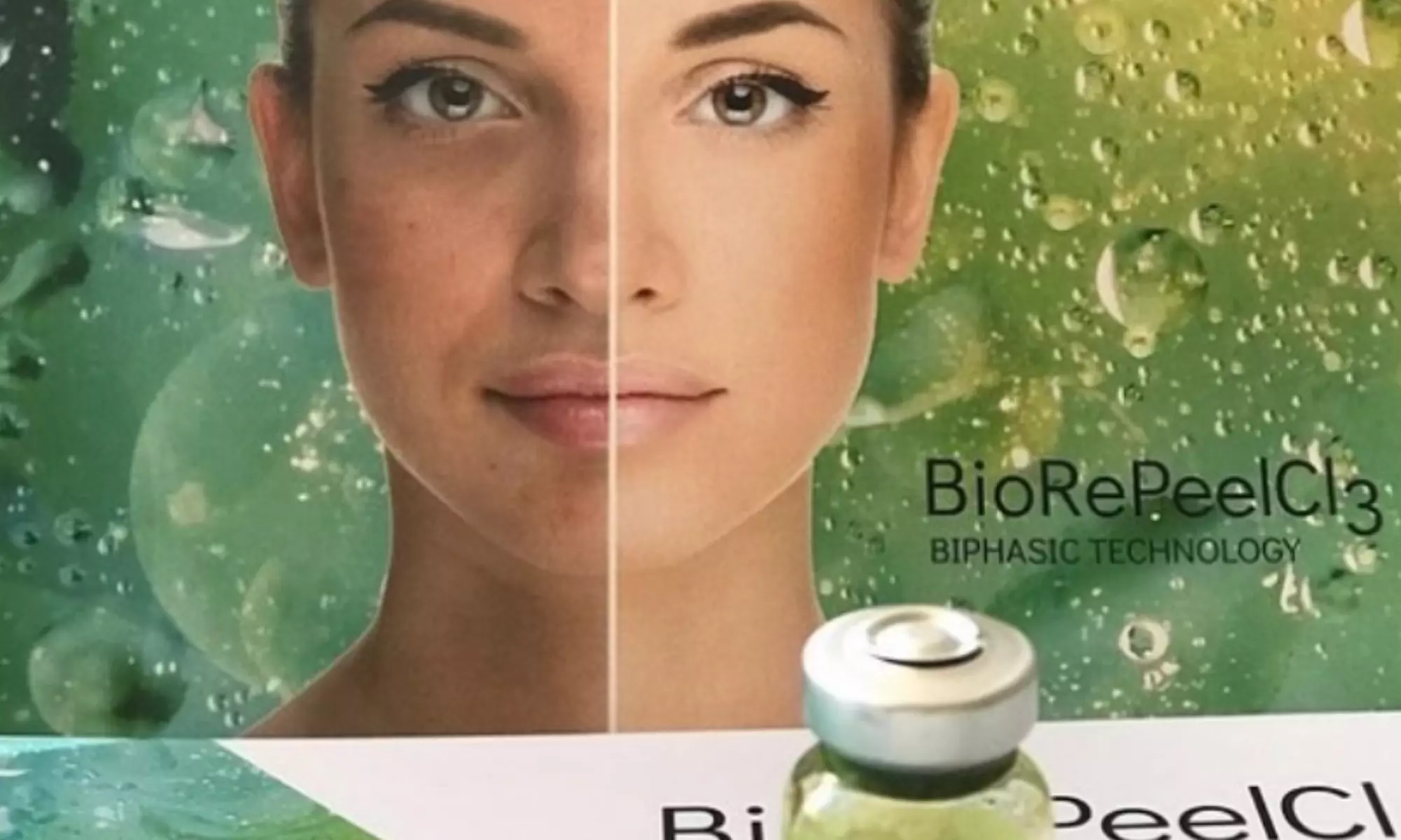 Chemical BioRePeel with Egyptian Rose Hydrating Alginate Mask or Vacuum Seal Jelly Mask (Up to 51% Off) - Primary Image
