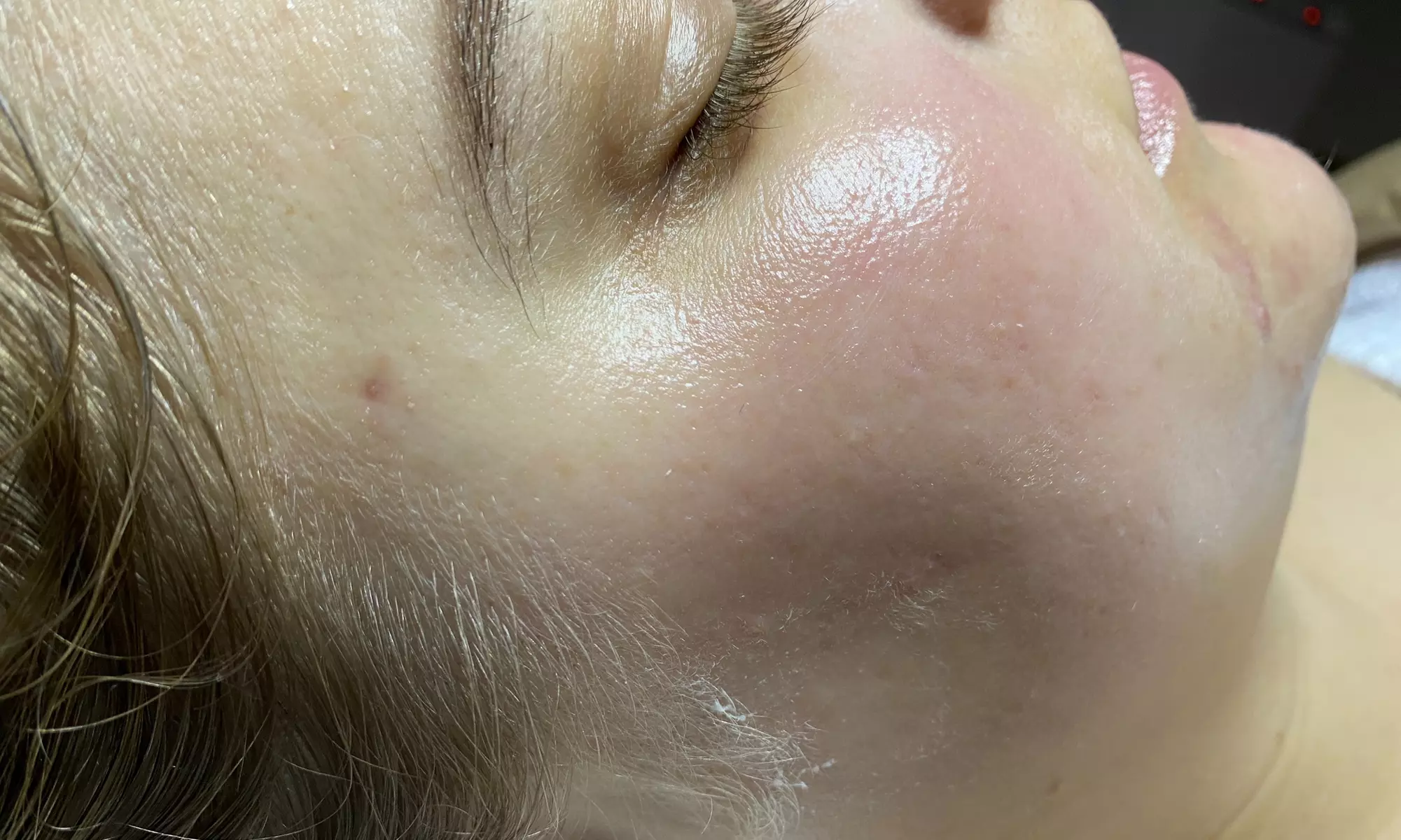 Up to 45% Off on Facial - Oxygen at Kylie Anne Esthetics