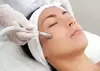 Up to 35% Off on Microdermabrasion at Hang's Spa