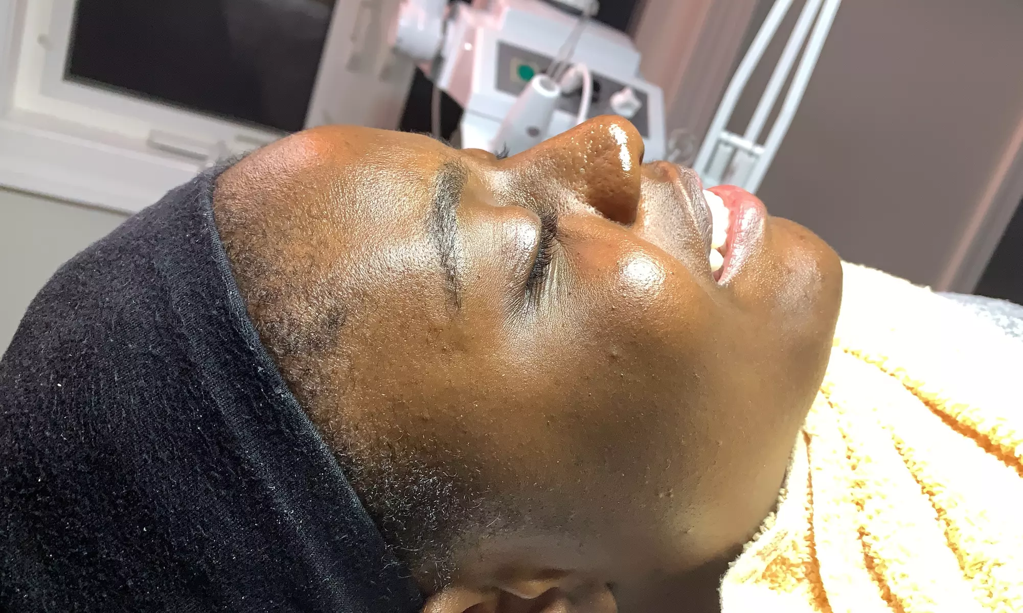 Up to 20% Off on Microdermabrasion at SaMecia Blount Natural Hair Co LLC: Solace Skin Lab - Primary Image