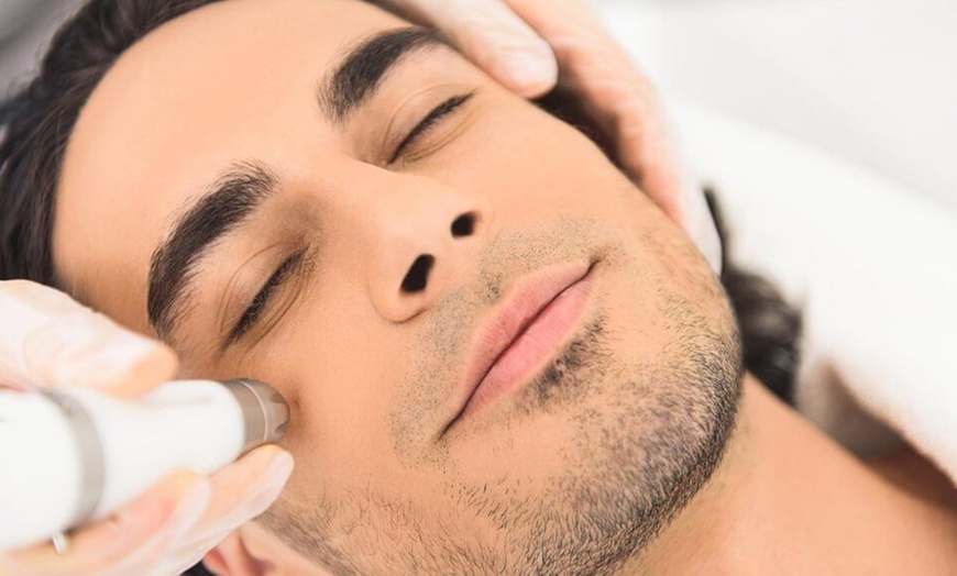 Image 2: Up to 69% Off on Facial - Men's at UK Aesthetics Lounge