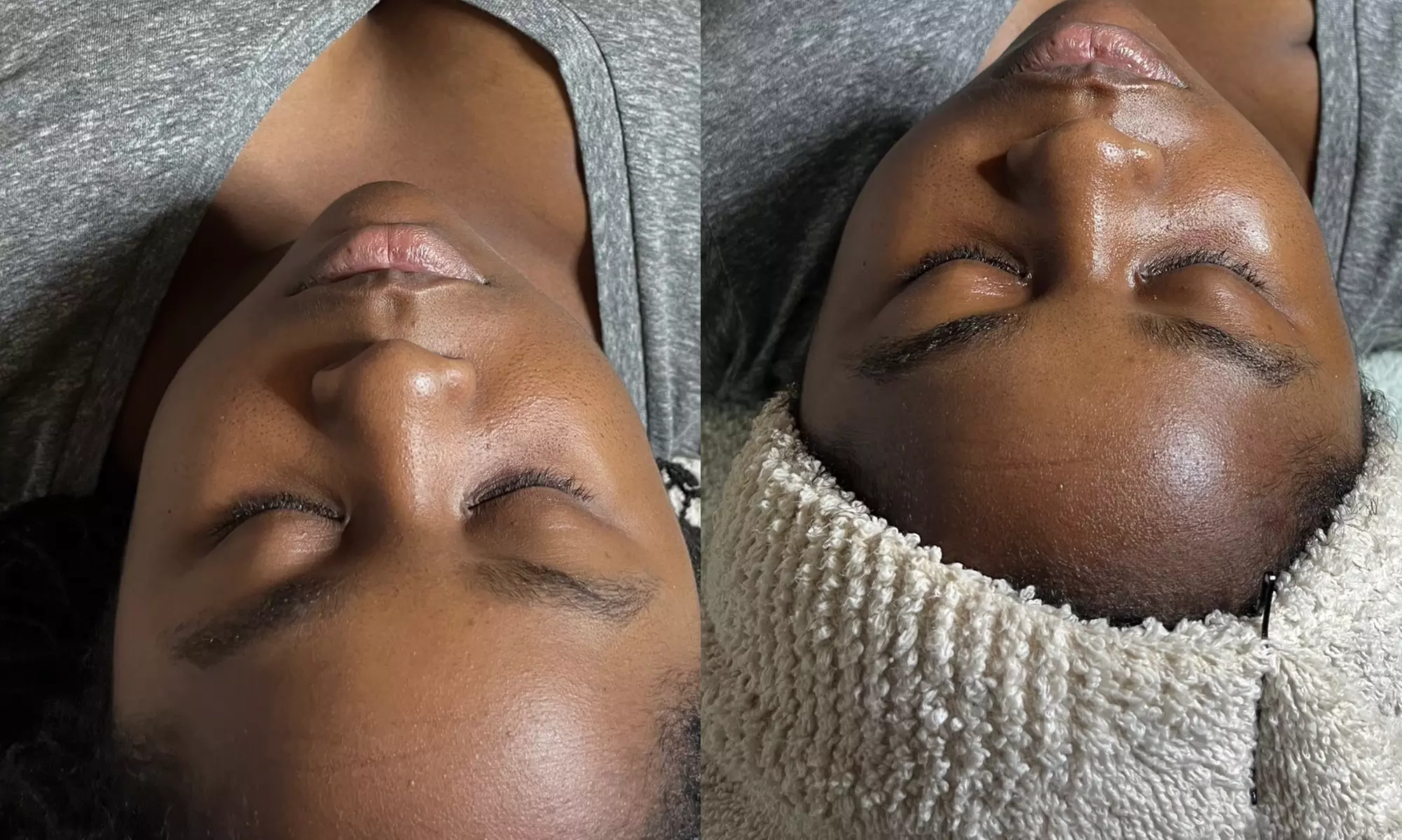 Up to 20% Off on Facial at Zen WYN Spa - Primary Image