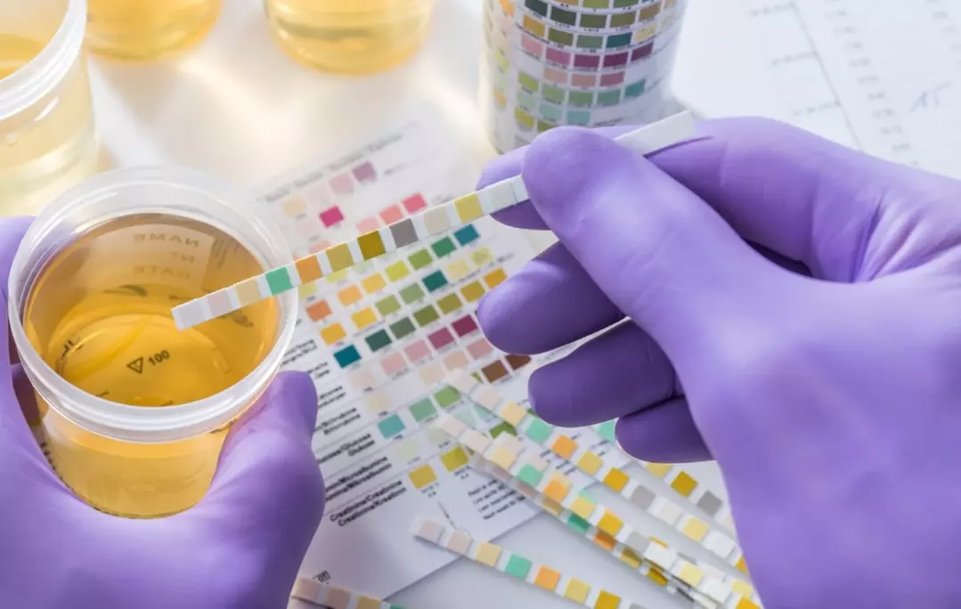 Discover comprehensive urinalysis options with Pink Mobile Labs & Diagnostics, offering up to 55% off on home UTI screenings - Primary Image