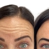 Image 2: Up to 43% Off on Injection - Botox at Cosmed Aesthetics