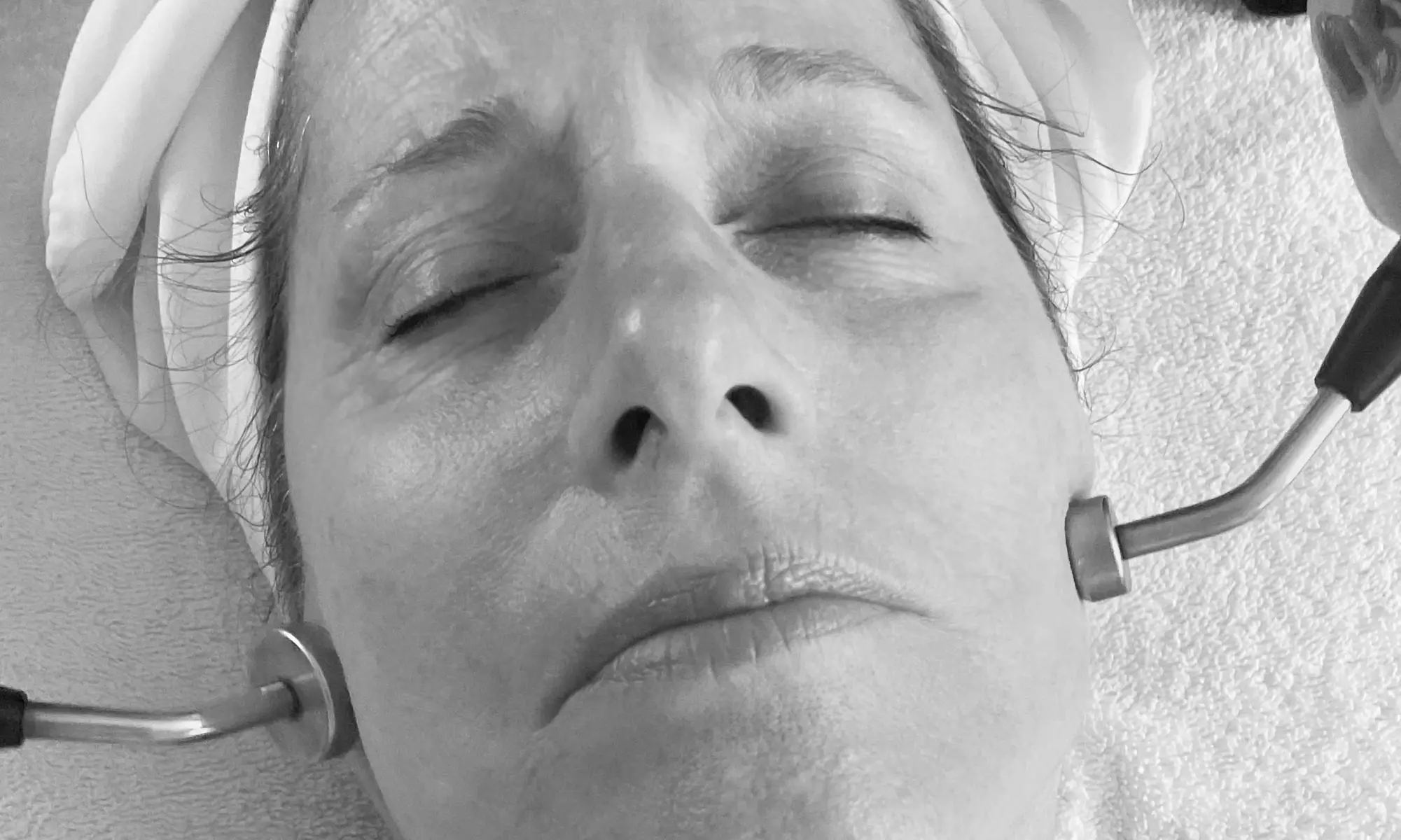 Up to 52% Off on Facelift - Non-Surgical at Microcurrent Healing - Second Medium