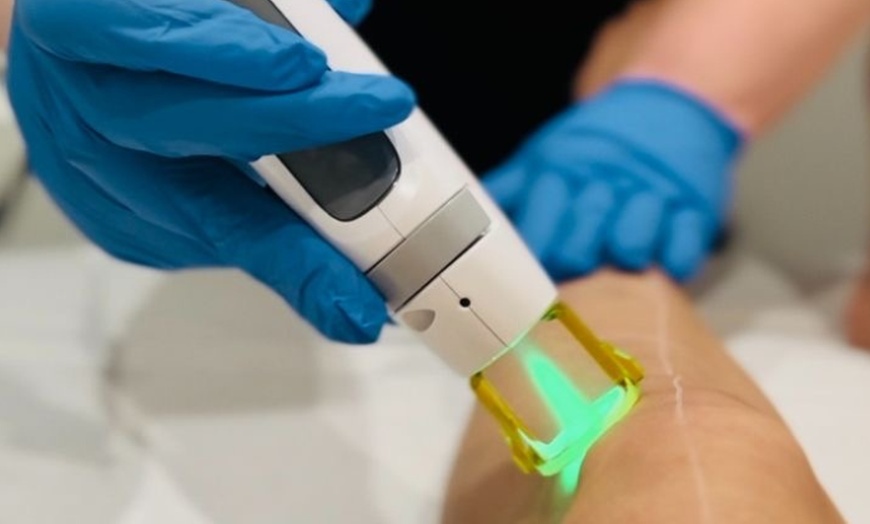 Image 3: Up to 62% Off on Laser Hair Removal at DAVI Aesthetics LLC