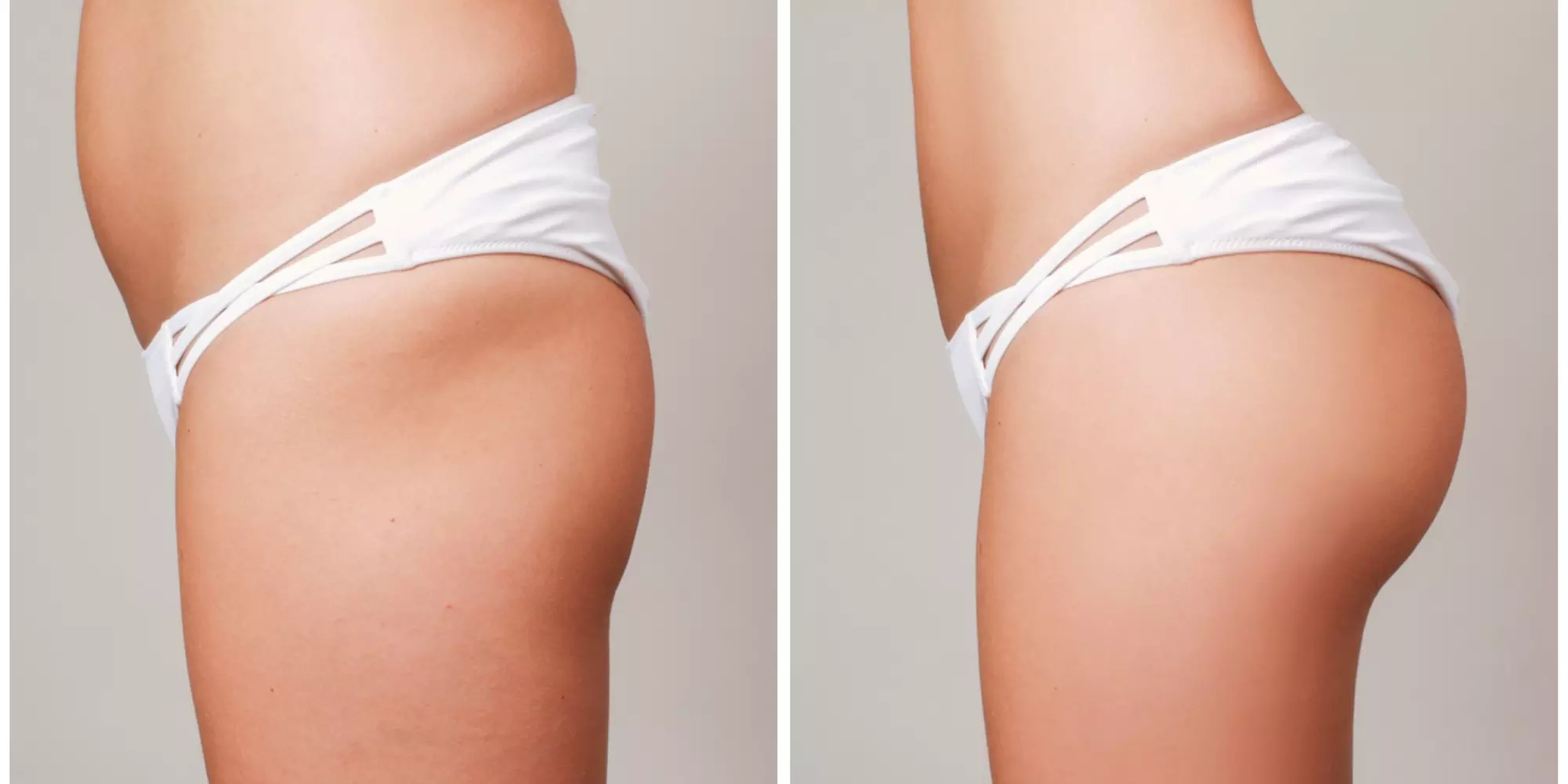 Experience a Brazilian Butt Lift with EMS Technology