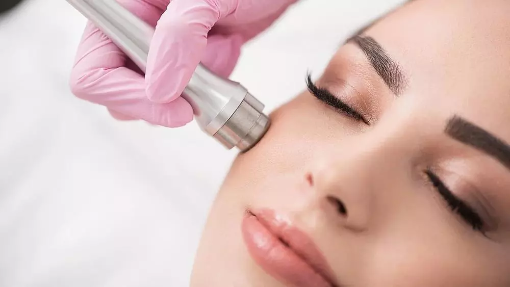Up to 30% Off on Microdermabrasion at Violet James Esthetics - Primary Image
