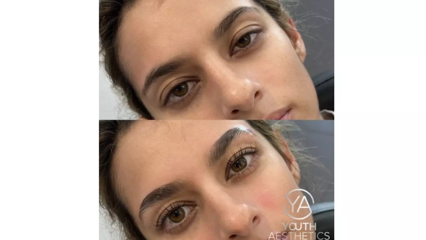 Up to 50% Off on Facial at Youth Aesthetics - Primary Image