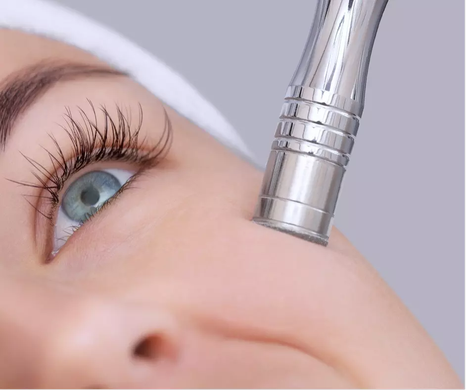 Up to 40% Off on Microdermabrasion Facial at Elena Van Etten Aesthetics LLC - Primary Image