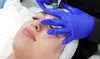 Up to 35% Off on HydraFacial at Brickell Cosmetic Center
