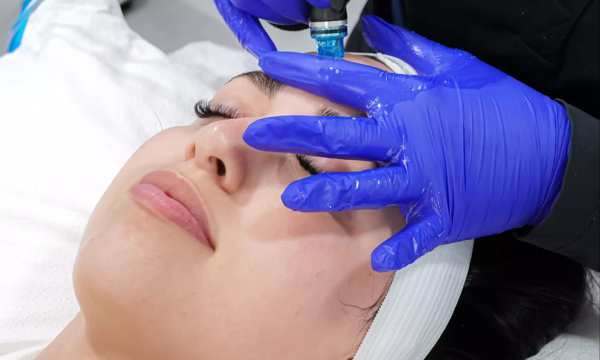 Up to 35% Off on HydraFacial at Brickell Cosmetic Center - Primary Image