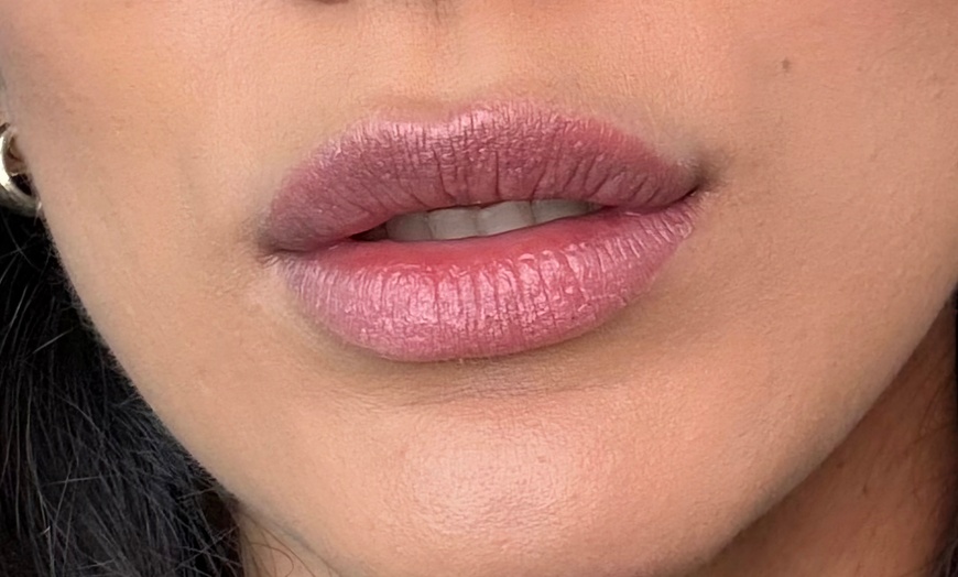 Image 3: Up to 46% Off on Lip Enhancement at Berry Lips by Jussara