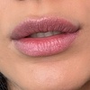 Image 3: Up to 46% Off on Lip Enhancement at Berry Lips by Jussara