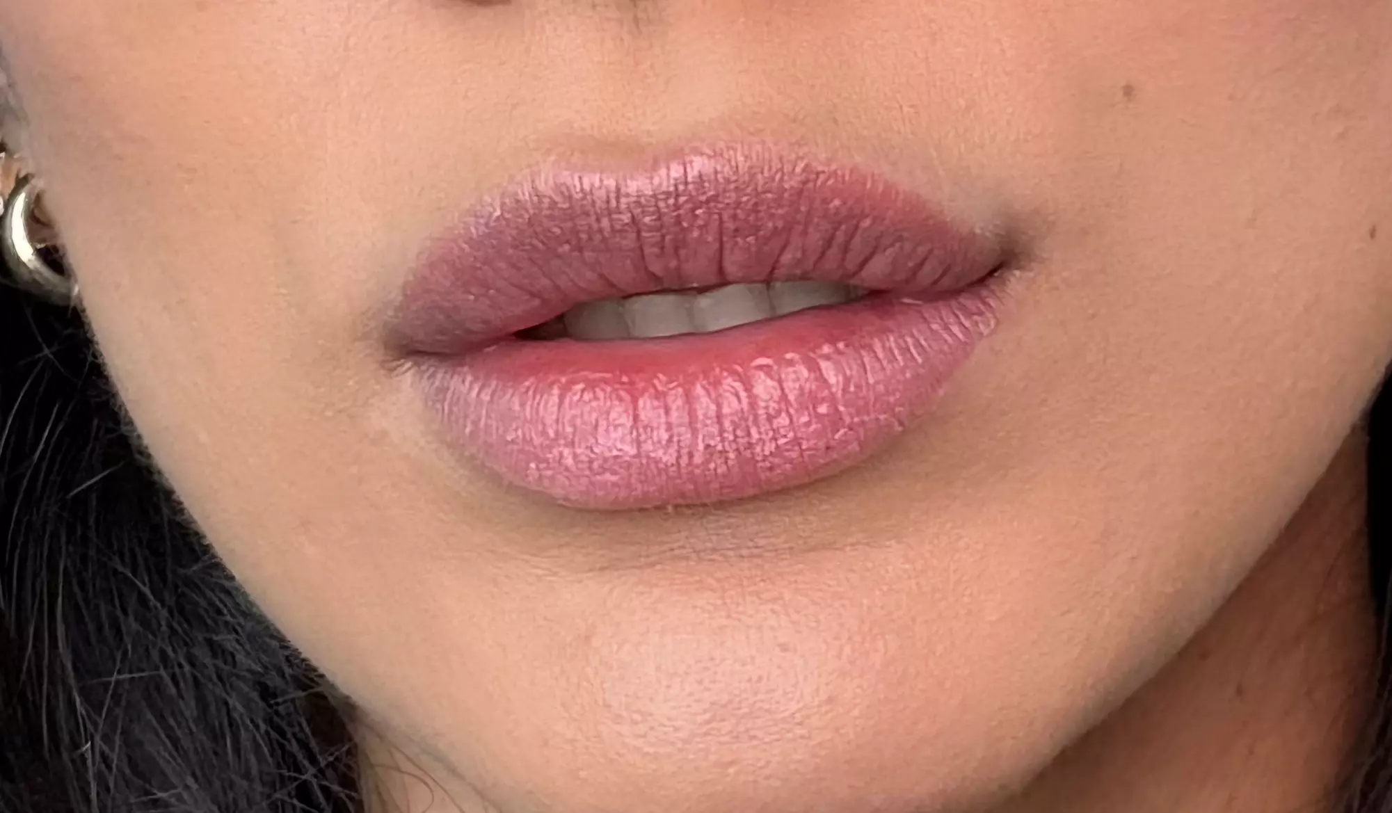 Up to 46% Off on Lip Enhancement at Berry Lips by Jussara