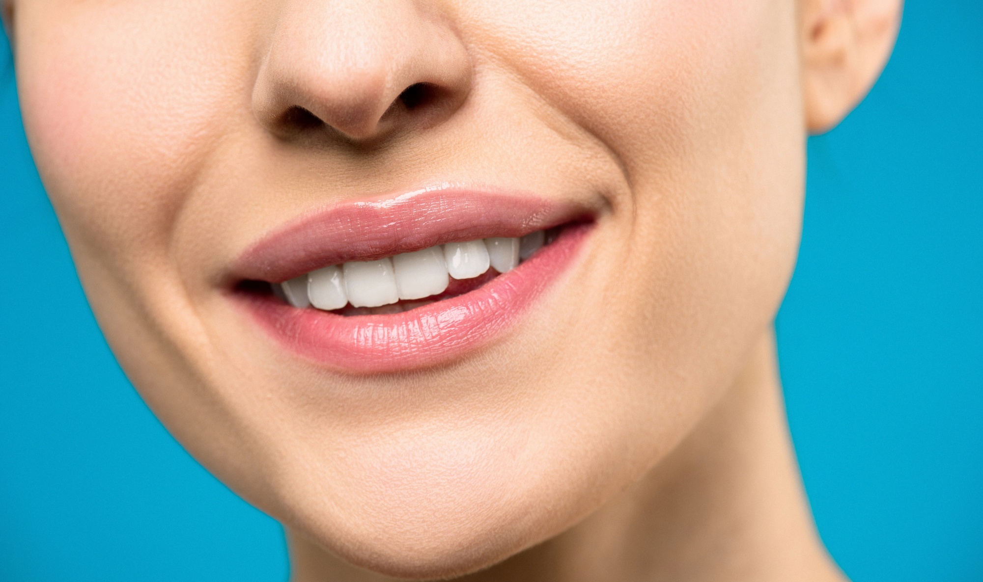 Up to 55% Off on Teeth Whitening - In-Office - Non-Branded at HD Bodies Salon