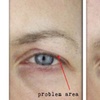 Image 8: Bella Hadid Style Eyebrow Lift With PDO Threads at No Pain All Gain Spa (Up to 30% Off)